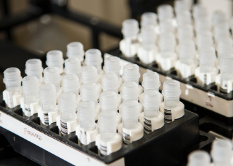 Tracking down human cancer mutations using supercomputers